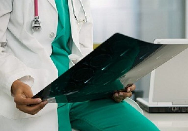 A radiografia ajudará o médico a diagnosticar “osteocondrose da coluna torácica”