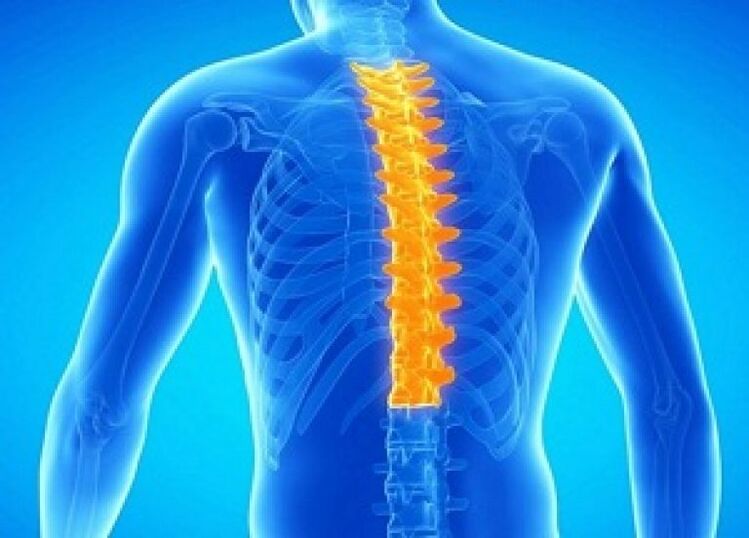 Osteocondrose da coluna torácica
