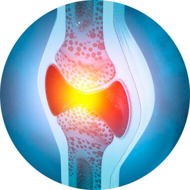 processo de restauração articular com gel Icexin